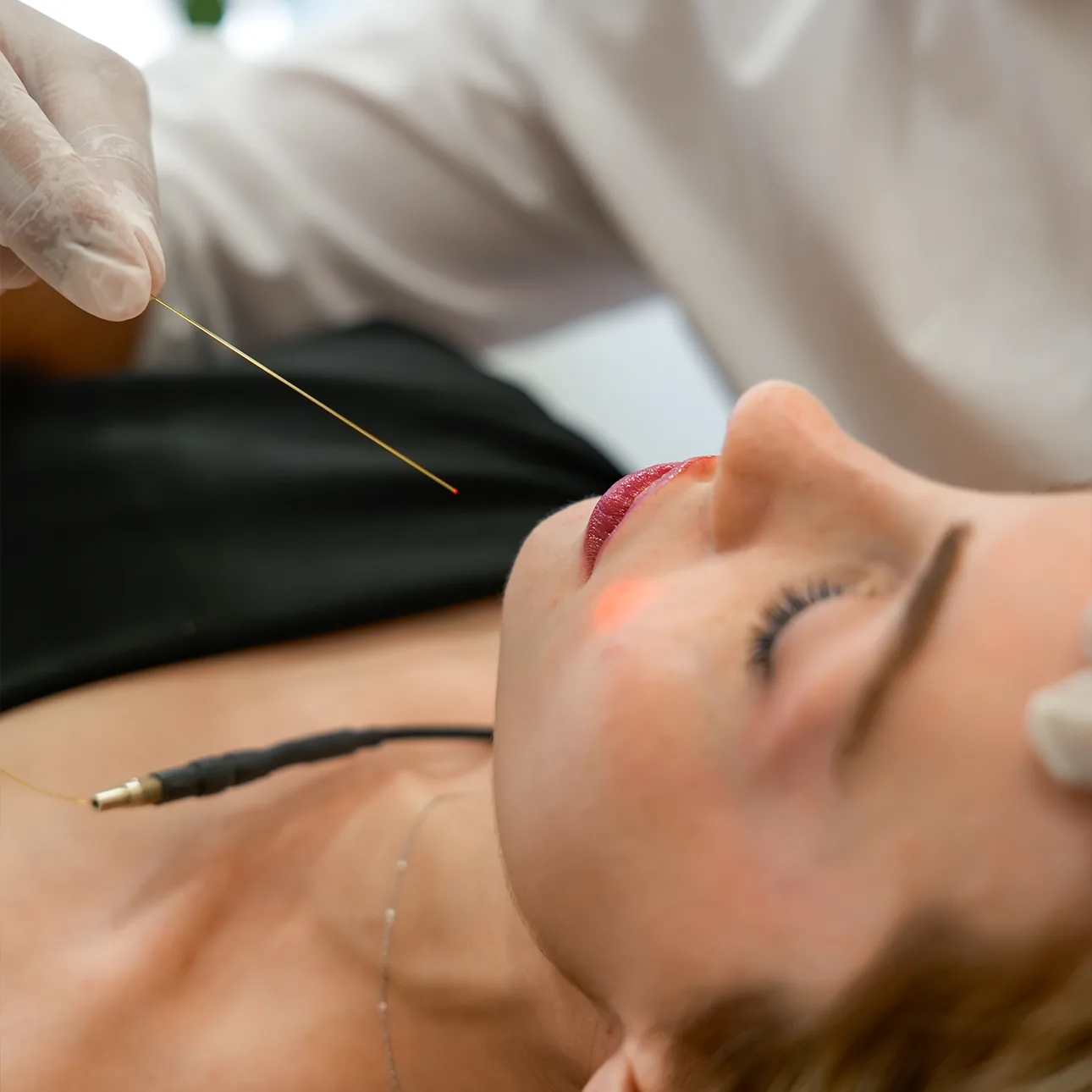 Endolift (Ameliyatsız Germe & Lazer Lipoliz)